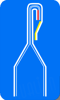 FBP-3W